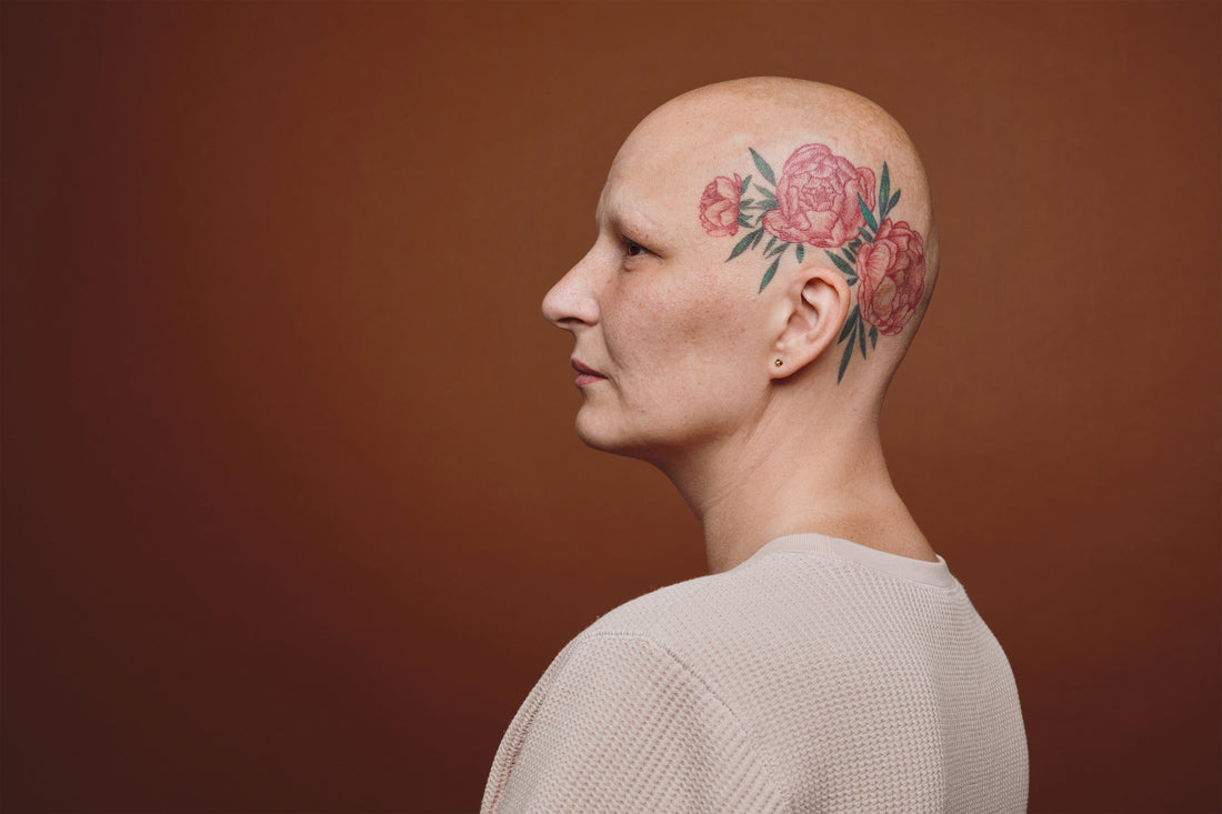What Is Alopecia? A Guide to the Main Types